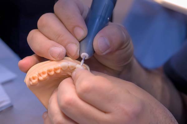 Five Questions To Ask A General Dentist About A Dental Implant Restoration